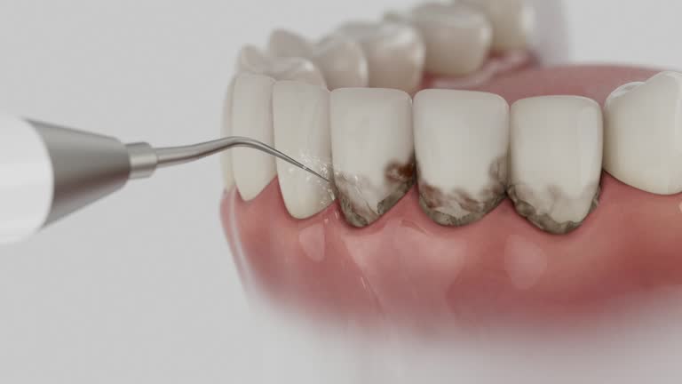 Reliable Dental Implants contractor in Davie County County, NC by Dentist Open Now
